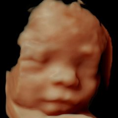 2025_BabyUltrasound1