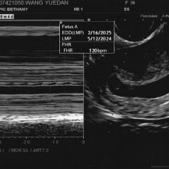 CrystalYuedanWang_Ultrasound_2024-06-27