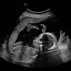 PerryWang_Baby_20Weeks