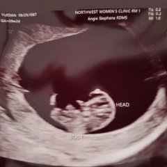 PerryWang_Ultrasound_9wk