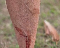 2026_TLC_Entrance_P1_ThoseNastyJamacianAgave This is an example of the work we do for VHL! Those nasty Jamacan Agave speared numerous TLC team members today!